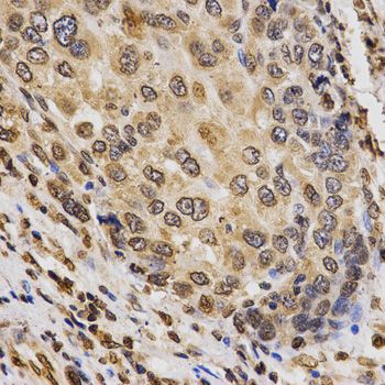 Immunohistochemistry - TriMethyl-Histone H3-K9 antibody (144-02360)