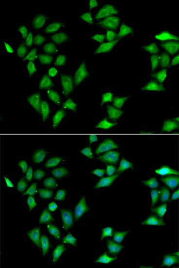 Immunofluorescence - ITLN1 antibody (144-07234)