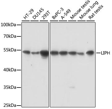 Western blot - LIPH antibody (144-015215)