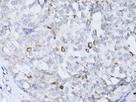 Immunohistochemistry - BRCA1 Polyclonal Antibody (144-11549)
