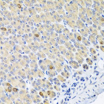 Immunohistochemistry - GLS Polyclonal Antibody (144-03885)