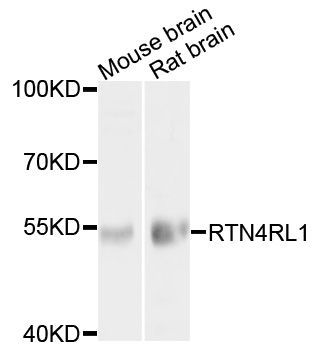 Western blot - RTN4RL1 Polyclonal Antibody (144-010021)