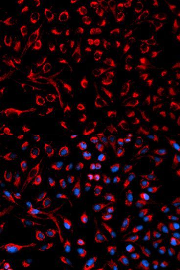 Immunofluorescence - DOK4 Polyclonal Antibody (144-00226)