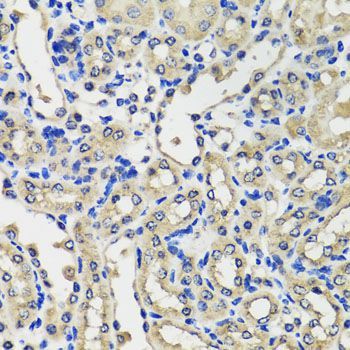 Immunohistochemistry - SCG3 Polyclonal Antibody (144-07799)