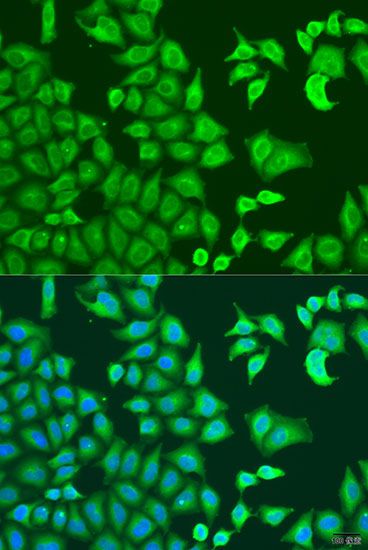 Immunofluorescence - CAPZB Polyclonal Antibody (144-08106)