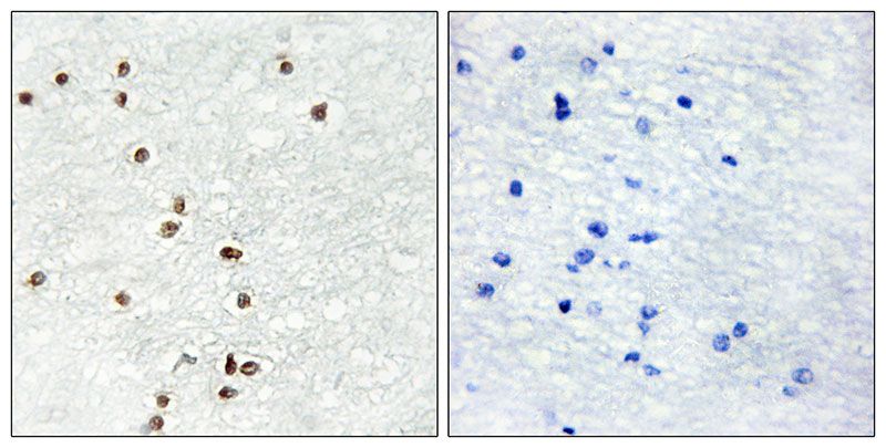 IHC