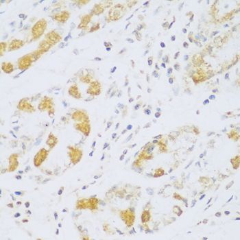 Immunohistochemistry - FDXR antibody (144-03860)
