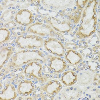 Immunohistochemistry - ND5 antibody (144-08135)