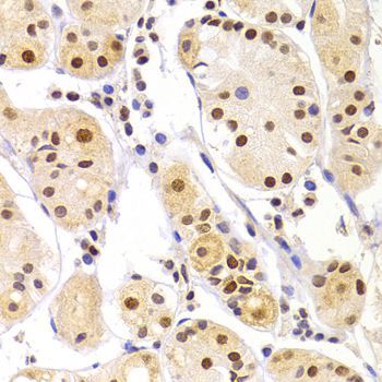 Immunohistochemistry - HNRNPA1 Polyclonal Antibody (144-07491)