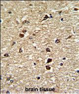 IHC-P