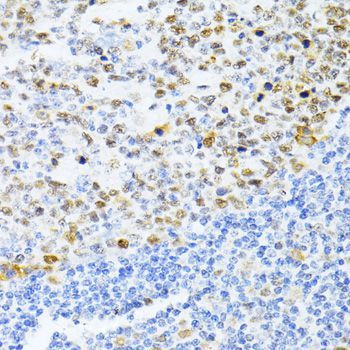 Immunofluorescence - DNMT1 Polyclonal Antibody (144-05495)