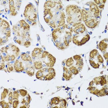 Immunohistochemistry - HDAC6 antibody (144-01732)