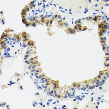 Immunohistochemistry - ST6GAL1 antibody (144-05754)