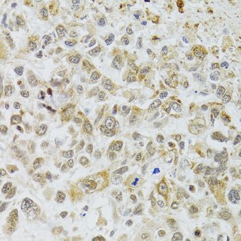 Immunohistochemistry - DMAP1 antibody (144-02324)