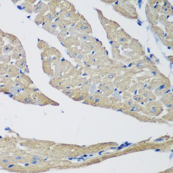 Immunohistochemistry - SMYD1 Polyclonal Antibody (144-02340)