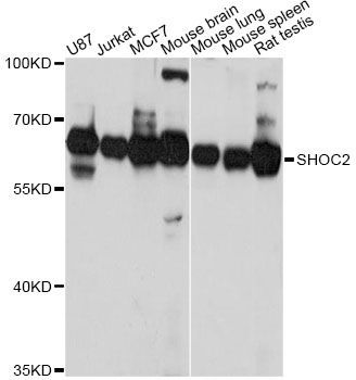 Western blot - SHOC2 Antibody (144-61383)