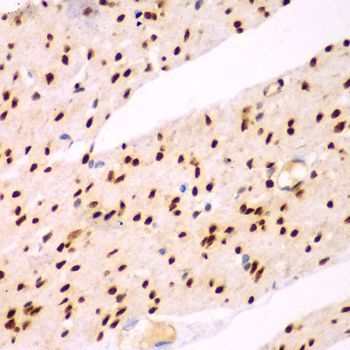 Immunohistochemistry - TEAD3 Polyclonal Antibody (144-07454)