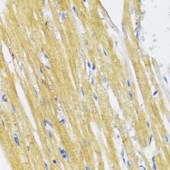 Immunohistochemistry - IKBKE Polyclonal Antibody (144-00244)