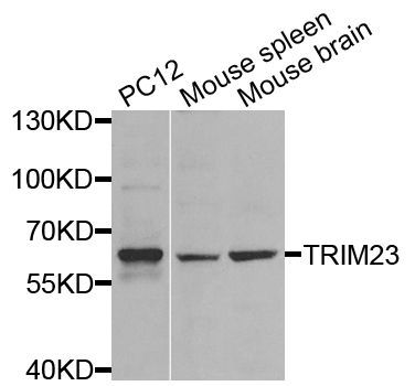 Western blot - TRIM23 antibody (144-08329)