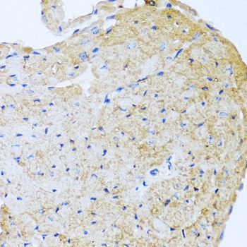 Immunohistochemistry - STC1 antibody (144-06755)