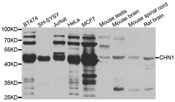 Western blot - CHN1 antibody (144-07546)