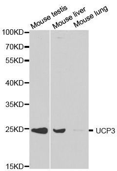 Western blot - UCP3 Polyclonal Antibody (144-01532)