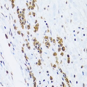Immunohistochemistry - KRT5 Antibody (144-02662)