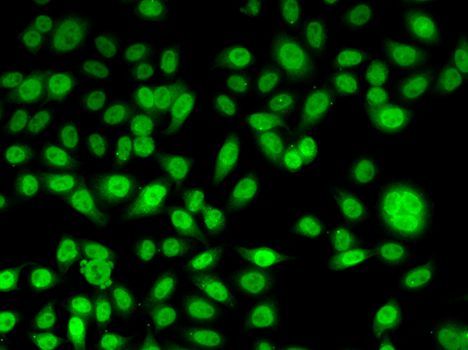 Immunofluorescence - PPL Polyclonal Antibody (144-06950)
