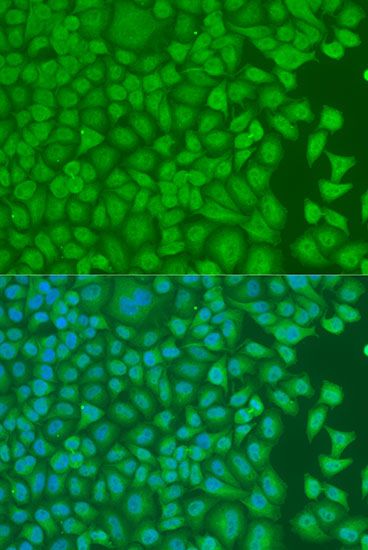 Immunofluorescence - PCBP1 Polyclonal Antibody (144-01044)