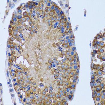 Immunohistochemistry - EIF2AK4 antibody (144-12618)