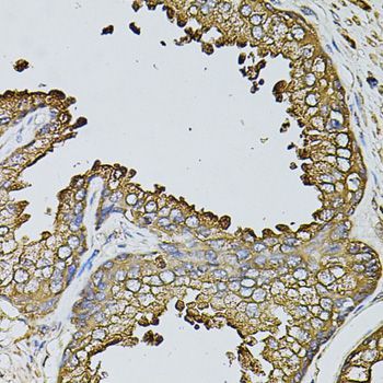 Immunohistochemistry - MYL1 antibody (144-08438)