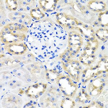 Immunohistochemistry - SCG3 Polyclonal Antibody (144-07799)