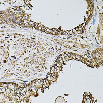 Immunohistochemistry - FDX1 antibody (144-09815)