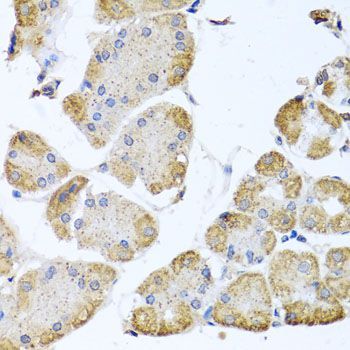 Immunohistochemistry - ITPKB antibody (144-03929)
