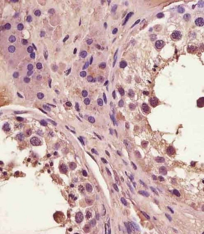 IHC-P