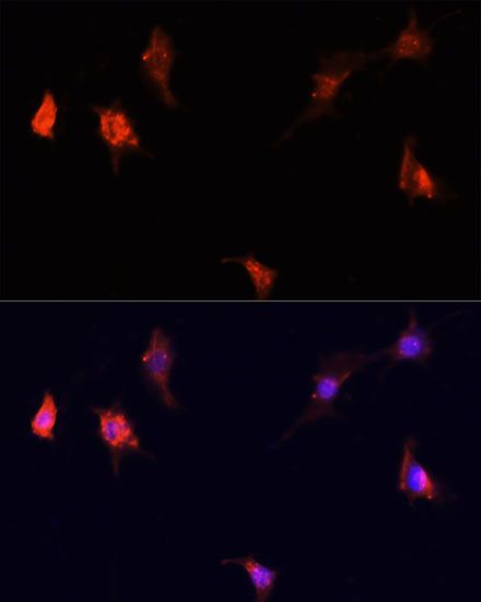 Immunofluorescence - mTOR Polyclonal Antibody (144-02445)