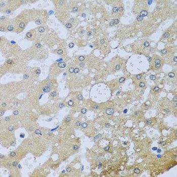 Immunohistochemistry - UQCR10 antibody (144-04674)