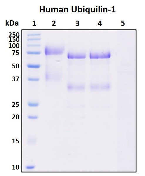 SDS-PAGE