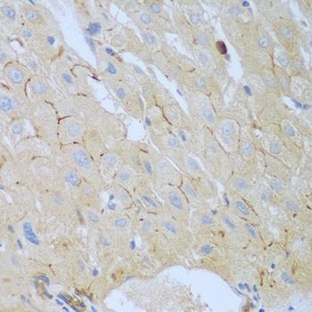 Immunohistochemistry - CEACAM7 antibody (144-08112)