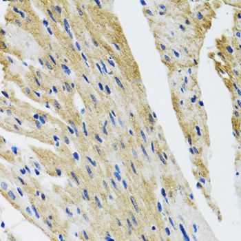 Immunohistochemistry - COPB2 Polyclonal Antibody (144-07036)