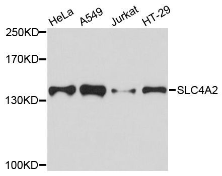 Western blot - SLC4A2 antibody (144-07729)