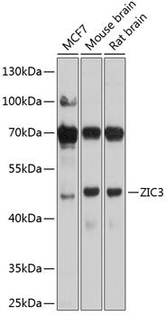 Western blot