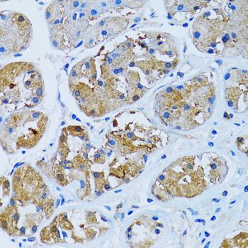 Immunohistochemistry - IMPA1 antibody (144-06381)