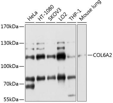 Western blot
