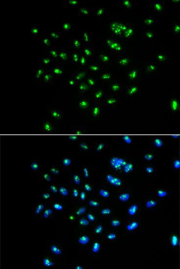 Immunofluorescence - GNL3 Polyclonal Antibody (144-06459)