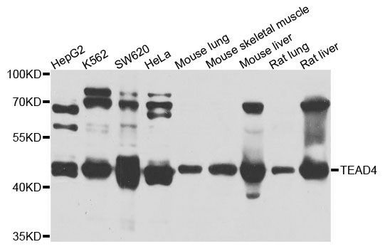 Western blot - TEAD4 Polyclonal Antibody (144-04151)