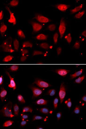 Immunofluorescence - RACGAP1 antibody (144-05298)