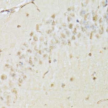Immunohistochemistry - HDAC3 Polyclonal Antibody (144-02139)