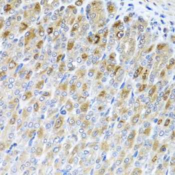 Immunohistochemistry - MTX2 antibody (144-07958)