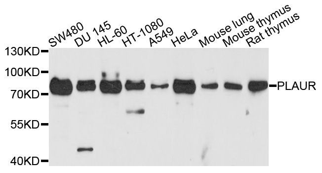 Western blot - PLAUR antibody (144-01397)